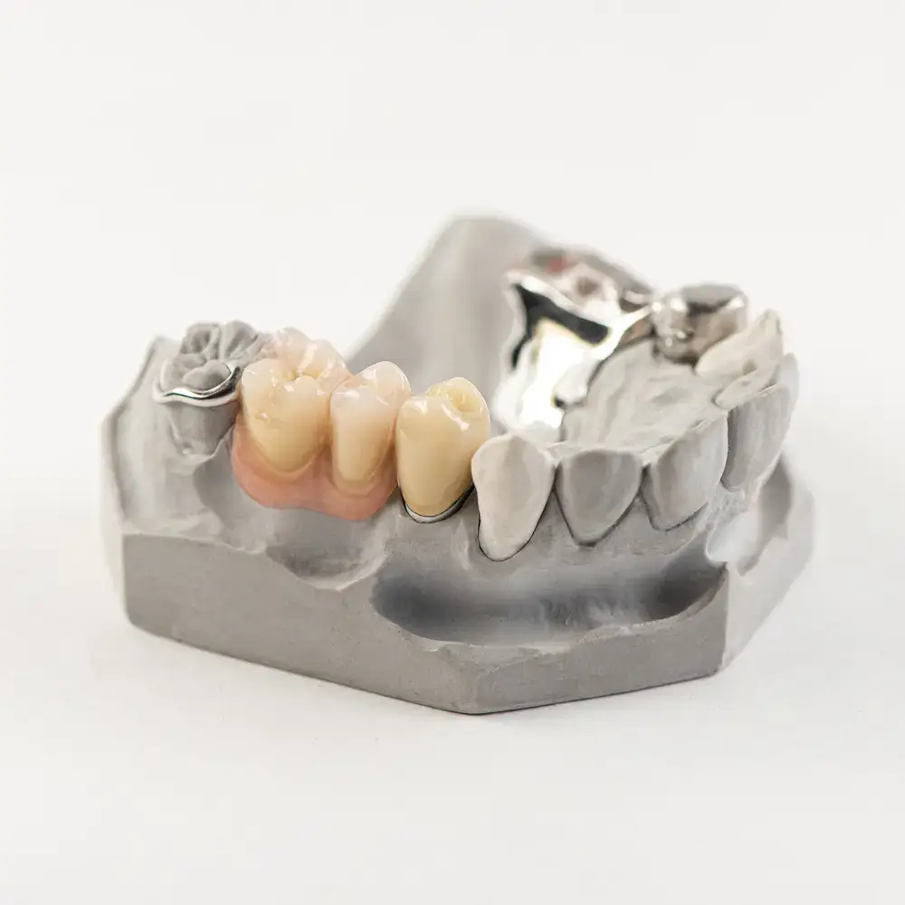 agens_modellguss_dentaltechnik_b
