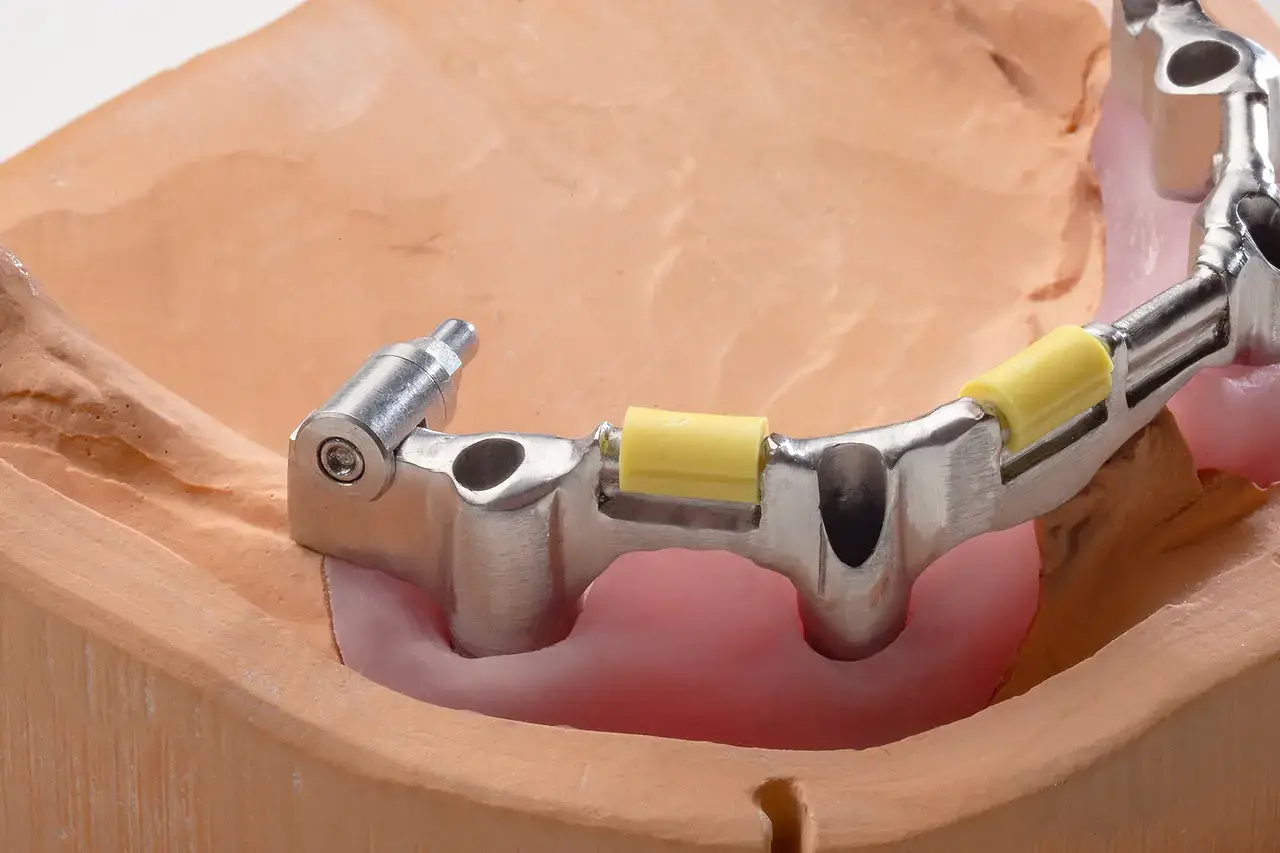 implantologie_dentale_restaurationen_12_b